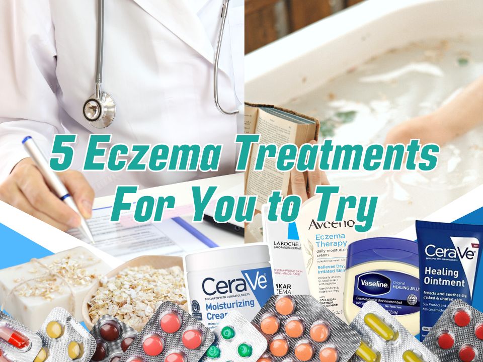 Treatment for Eczema to Live a Comfortable Life