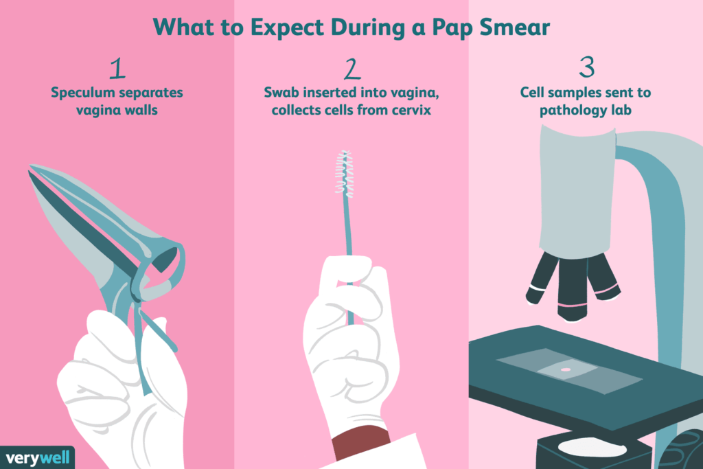 What Happens During A Pap Smear?