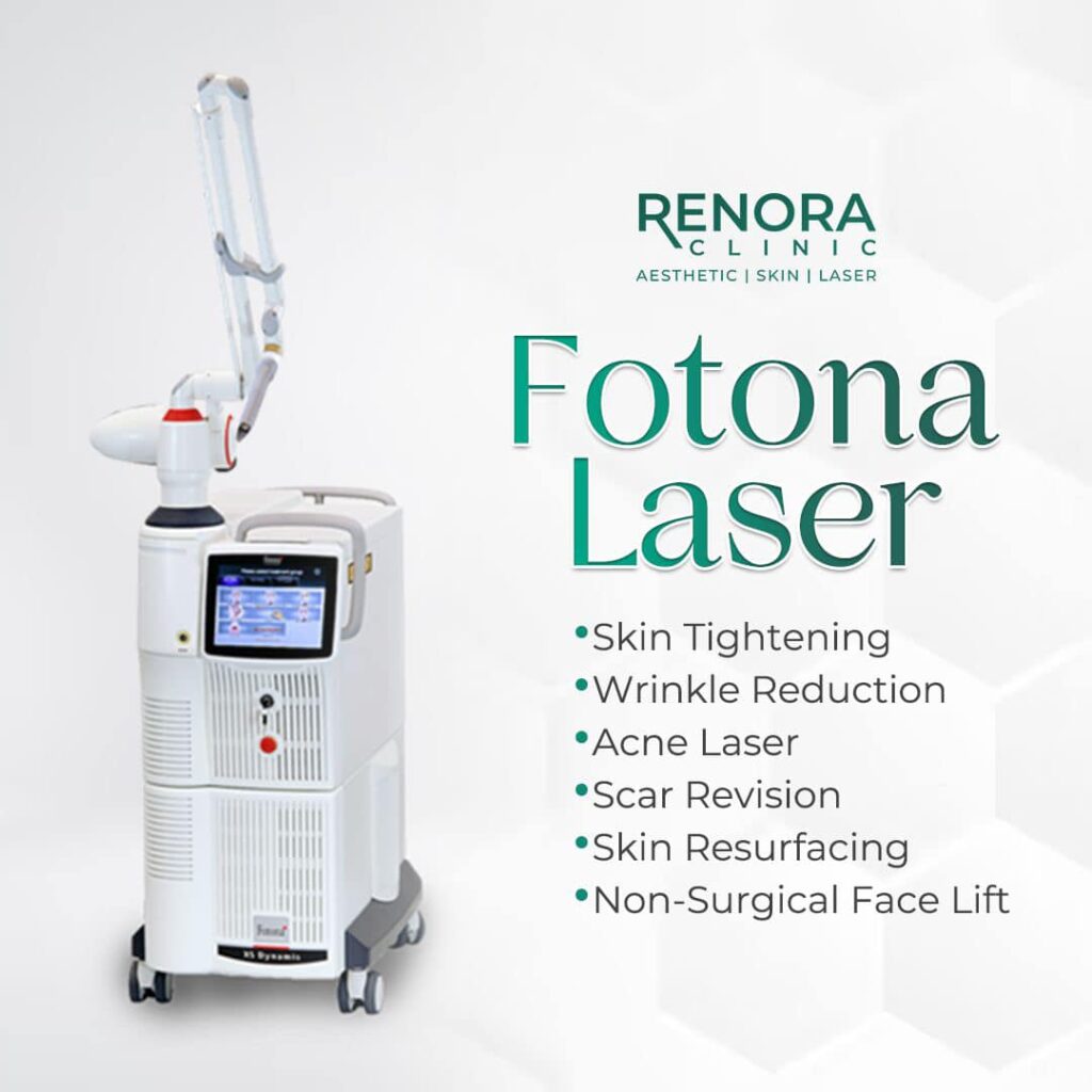 Fotona Laser Treatment