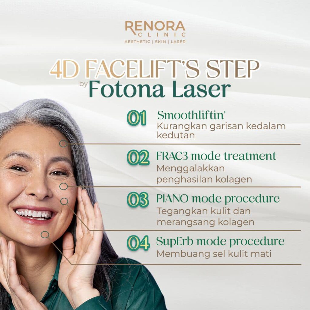 4D facelift steps Fotona laser 
