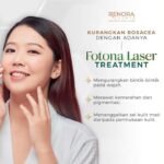 Experience The Magic Of Fotona Laser Treatment @ Renora Clinic Cheras