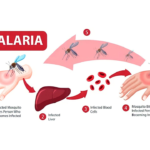 Defeating Malaria By Knowing The Symptoms, Causes & Solutions