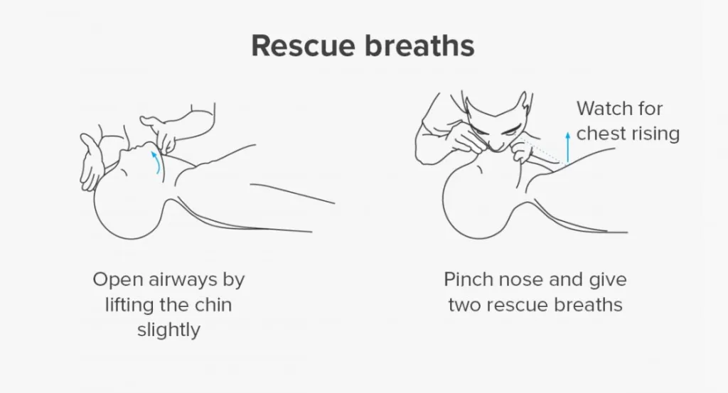 Steps To Give CPR
