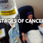 Understanding The Stages In Cancer