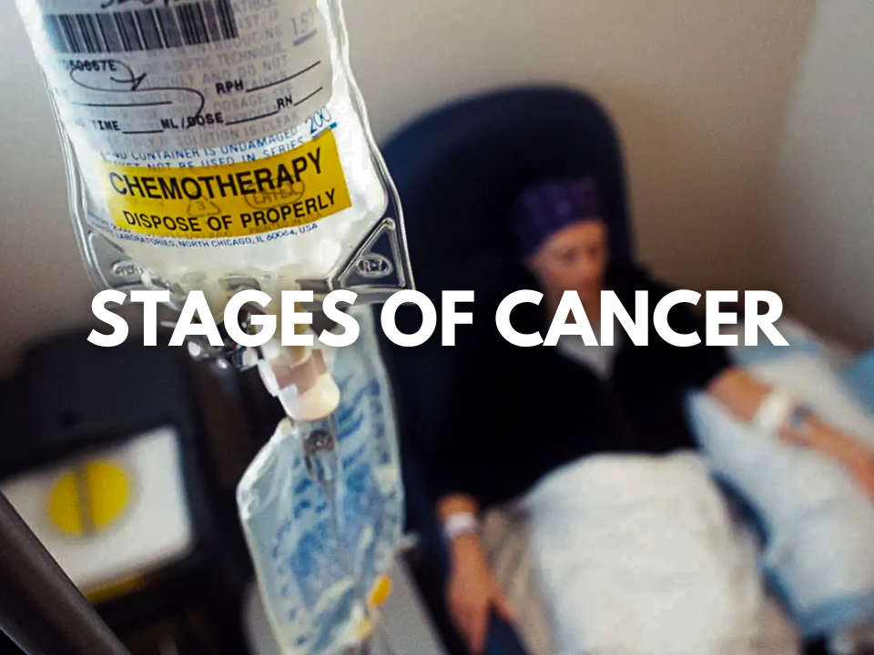 Understanding The Stages In Cancer