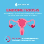 Endometriosis Awareness Month with TMC Fertility