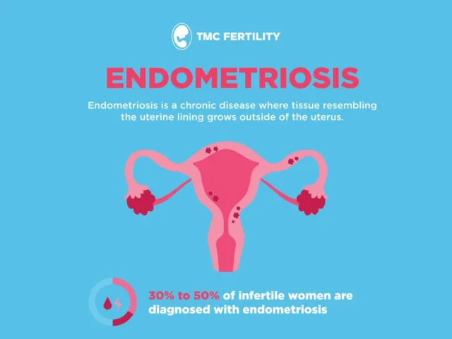 Endometriosis Awareness Month with TMC Fertility