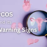 Understanding PCOS: Recognizing The Warning Signs