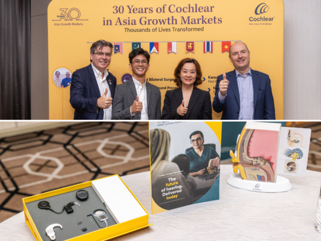 cochlear smart hearing